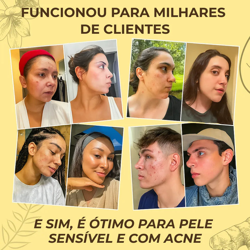 Sabonete Clareador e Antissépticos de Açafrão com Dolomita